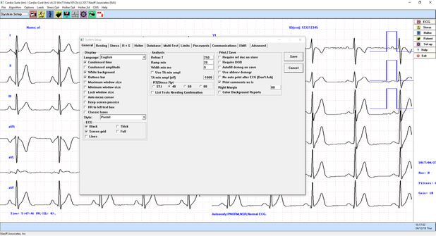 CardioCard® ECG Screenshot